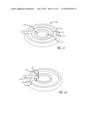 ASSEMBLY AND METHOD FOR AUTOMATICALLY CONTROLLING PRESSURE FOR A GASTRIC BAND diagram and image