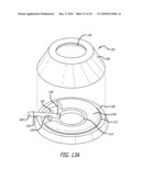 ASSEMBLY AND METHOD FOR AUTOMATICALLY CONTROLLING PRESSURE FOR A GASTRIC BAND diagram and image