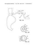 ASSEMBLY AND METHOD FOR AUTOMATICALLY CONTROLLING PRESSURE FOR A GASTRIC BAND diagram and image