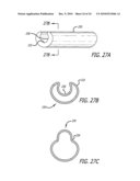 ASSEMBLY AND METHOD FOR AUTOMATICALLY CONTROLLING PRESSURE FOR A GASTRIC BAND diagram and image