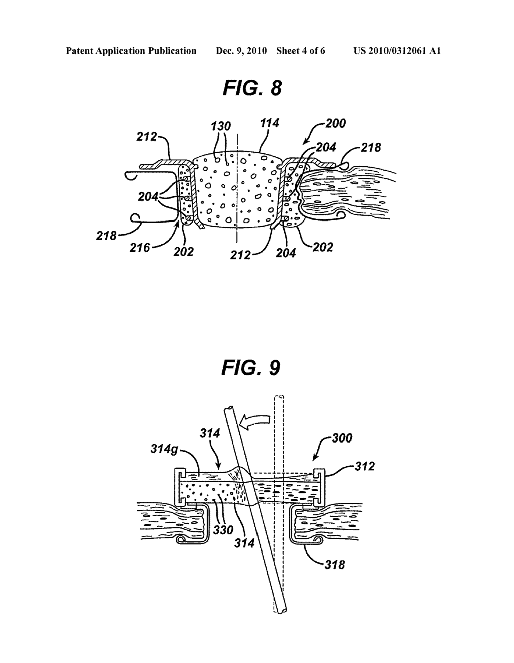 METHODS AND DEVICES FOR PROVIDING ACCESS THROUGH TISSUE TO A SURGICAL SITE - diagram, schematic, and image 05