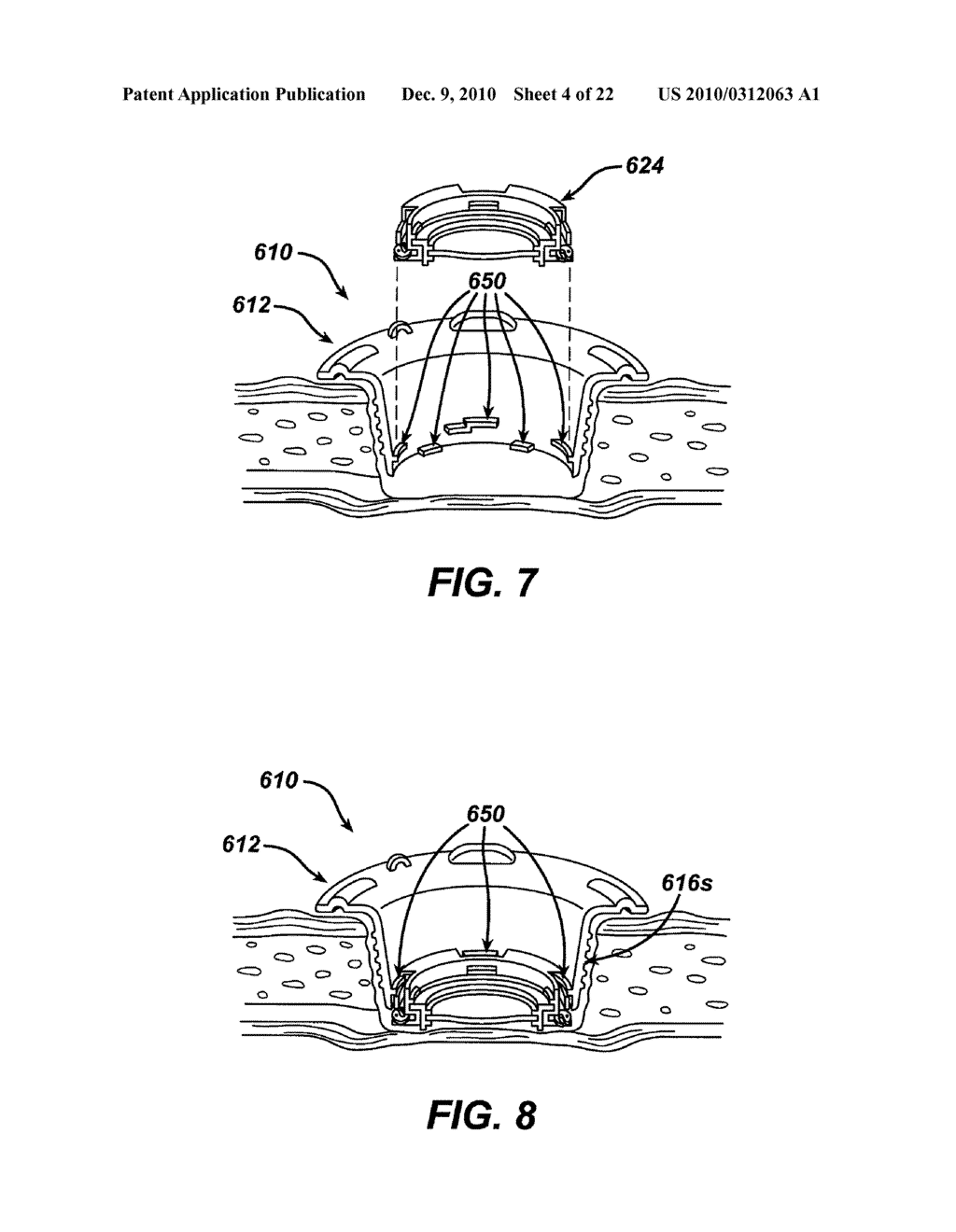 METHODS AND DEVICES FOR ACCESSING A BODY CAVITY USING A SURGICAL ACCESS DEVICE WITH MODULAR SEAL COMPONENTS - diagram, schematic, and image 05