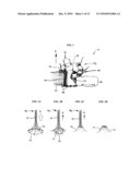 RETRACTOR WITH INTEGRATED WOUND CLOSURE diagram and image