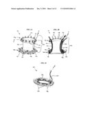 RETRACTOR WITH INTEGRATED WOUND CLOSURE diagram and image