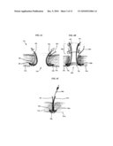 RETRACTOR WITH INTEGRATED WOUND CLOSURE diagram and image