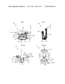 RETRACTOR WITH INTEGRATED WOUND CLOSURE diagram and image