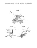 RETRACTOR WITH INTEGRATED WOUND CLOSURE diagram and image