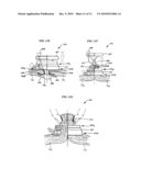 RETRACTOR WITH INTEGRATED WOUND CLOSURE diagram and image