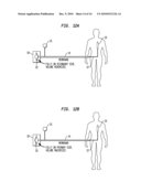 Calibration of in vivo blood pressure sensors diagram and image