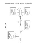 Calibration of in vivo blood pressure sensors diagram and image