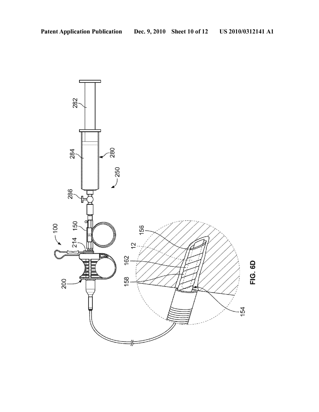 TISSUE SAMPLING DEVICES, SYSTEMS AND METHODS - diagram, schematic, and image 11