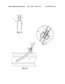 ADAPTER FOR USE IN CONNECTING TO A FIRST PERCUTANEOUS INTRODUCER diagram and image