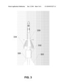 Devices and Methods for Catheter Advancement diagram and image