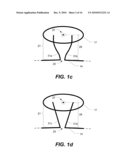 Capsulotomy Repair Device and Method for Capsulotomy Repair diagram and image