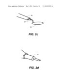 Capsulotomy Repair Device and Method for Capsulotomy Repair diagram and image