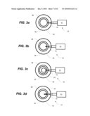 Capsulotomy Repair Device and Method for Capsulotomy Repair diagram and image