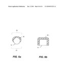 Capsulotomy Repair Device and Method for Capsulotomy Repair diagram and image