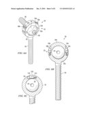 EXTERNAL FIXATOR RING diagram and image