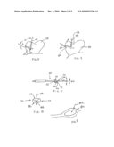 Surgical Drill Guide With Awl and Method of Use diagram and image