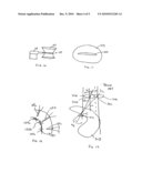 Surgical Drill Guide With Awl and Method of Use diagram and image