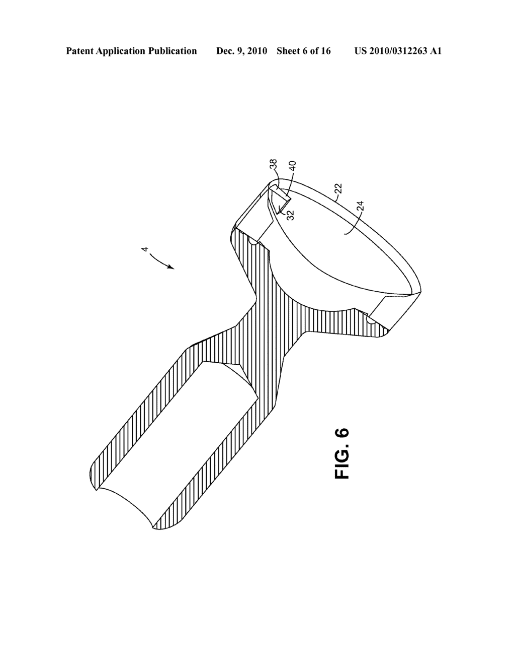 METHODS AND DEVICES FOR CUTTING AND ABRADING TISSUE - diagram, schematic, and image 07