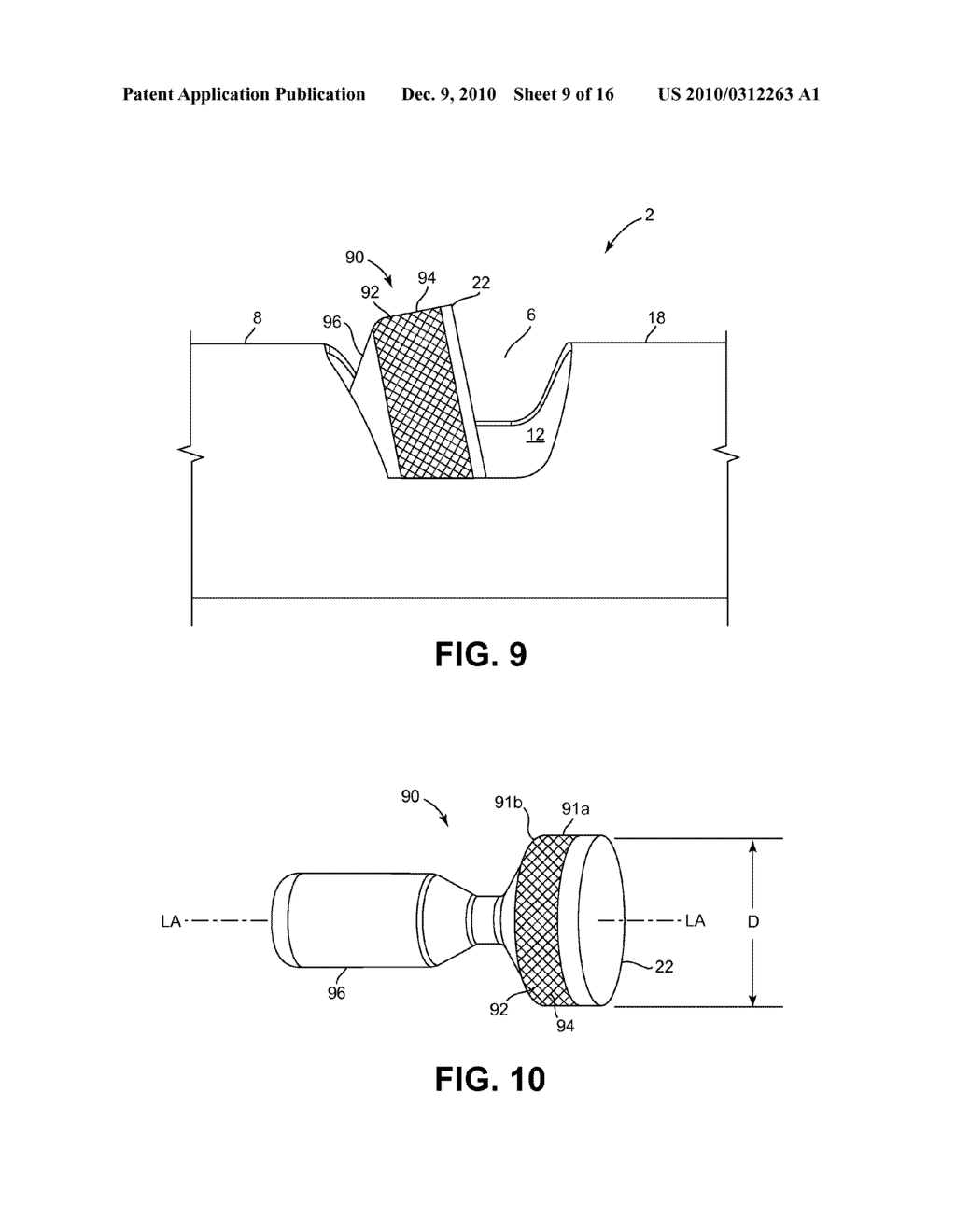METHODS AND DEVICES FOR CUTTING AND ABRADING TISSUE - diagram, schematic, and image 10