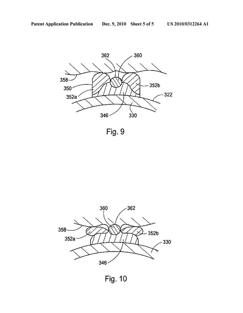 CUTTING BALLOON HAVING SHEATHED INCISING ELEMENTS - diagram, schematic, and image 06