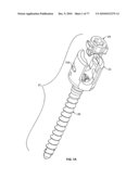 Minimally Invasive Surgical System diagram and image