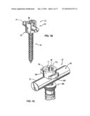 Minimally Invasive Surgical System diagram and image