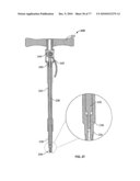 Minimally Invasive Surgical System diagram and image