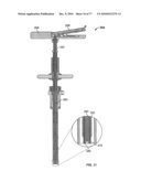 Minimally Invasive Surgical System diagram and image