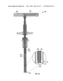 Minimally Invasive Surgical System diagram and image