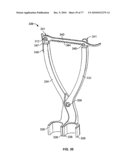 Minimally Invasive Surgical System diagram and image