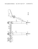 Minimally Invasive Surgical System diagram and image