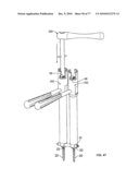 Minimally Invasive Surgical System diagram and image