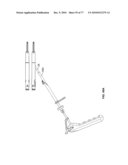 Minimally Invasive Surgical System diagram and image