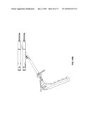 Minimally Invasive Surgical System diagram and image