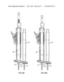 Minimally Invasive Surgical System diagram and image