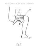 ELECTROTHERAPY APPARATUS diagram and image