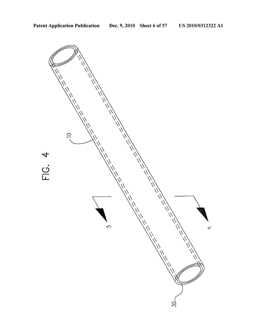 Medical Balloon Incorporating Electroactive Polymer and Methods of Making and Using the Same - diagram, schematic, and image 07