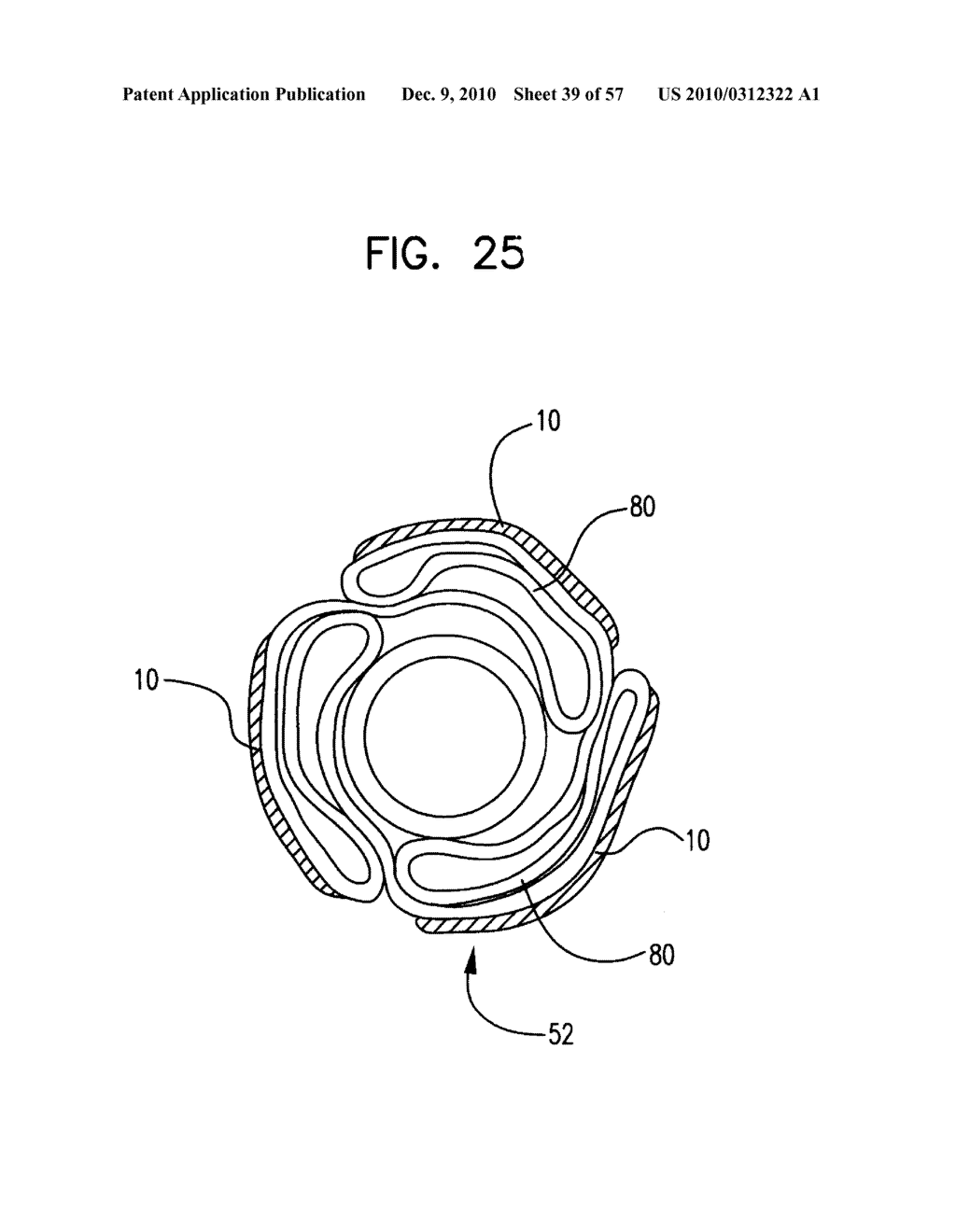 Medical Balloon Incorporating Electroactive Polymer and Methods of Making and Using the Same - diagram, schematic, and image 40