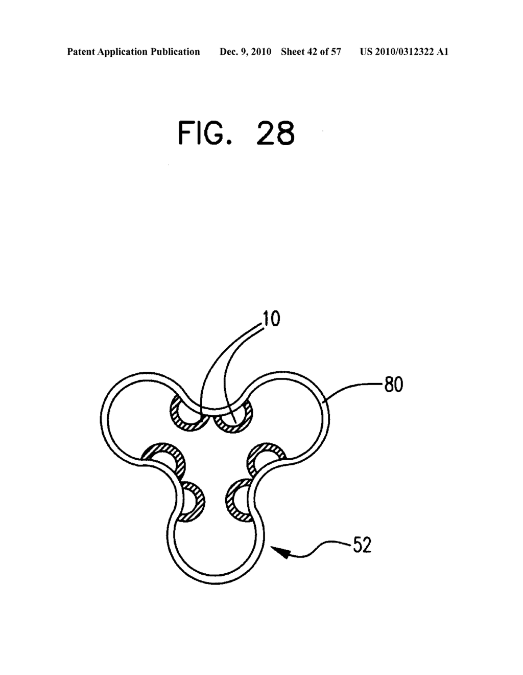 Medical Balloon Incorporating Electroactive Polymer and Methods of Making and Using the Same - diagram, schematic, and image 43