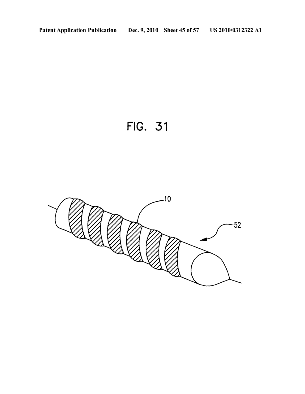 Medical Balloon Incorporating Electroactive Polymer and Methods of Making and Using the Same - diagram, schematic, and image 46