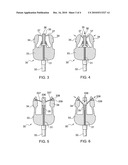 Cut away vest diagram and image