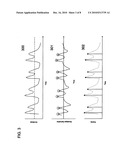 RHYTHM RECOGNITION FROM AN AUDIO SIGNAL diagram and image