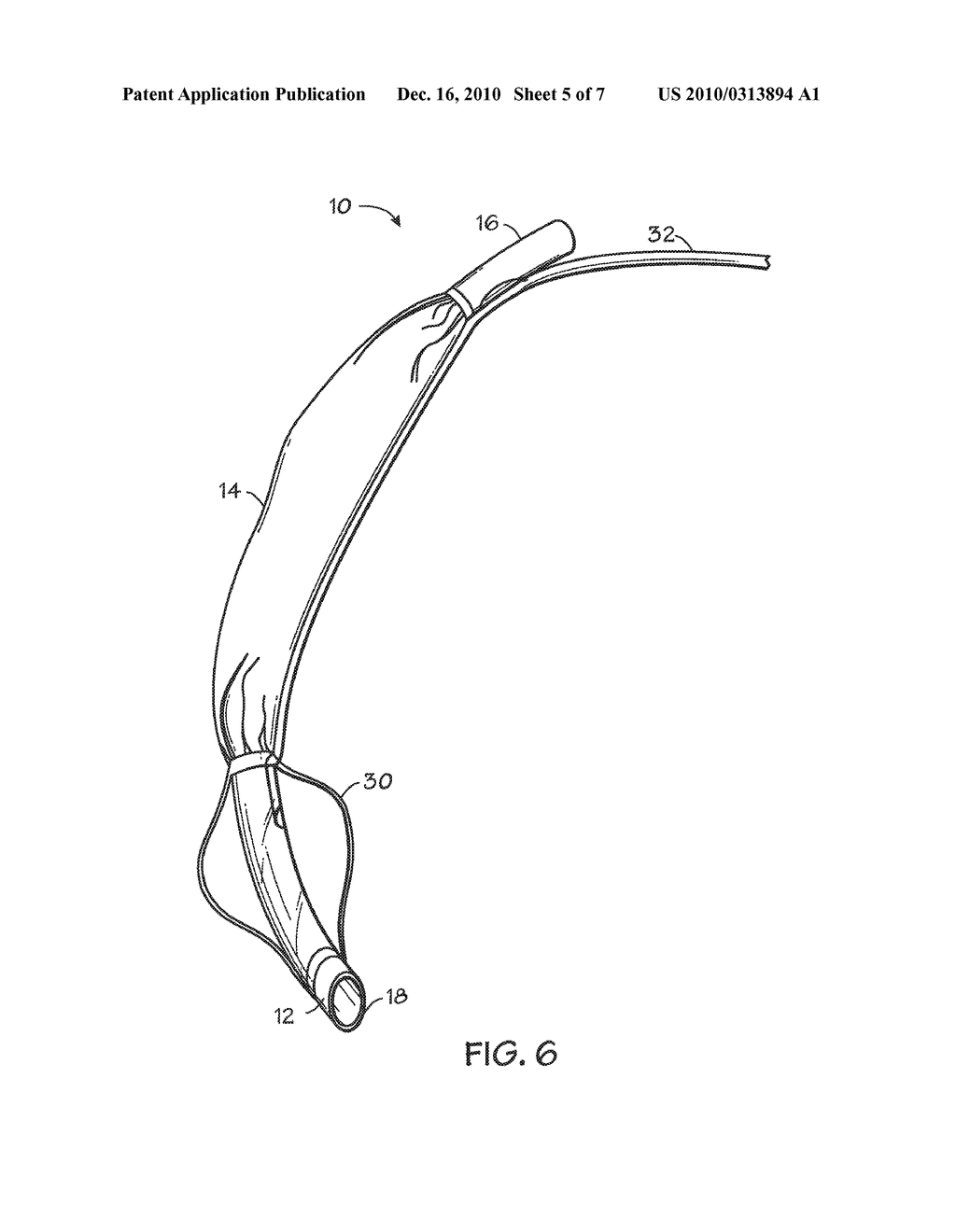 SELF-SIZING ADJUSTABLE ENDOTRACHEAL TUBE - diagram, schematic, and image 06