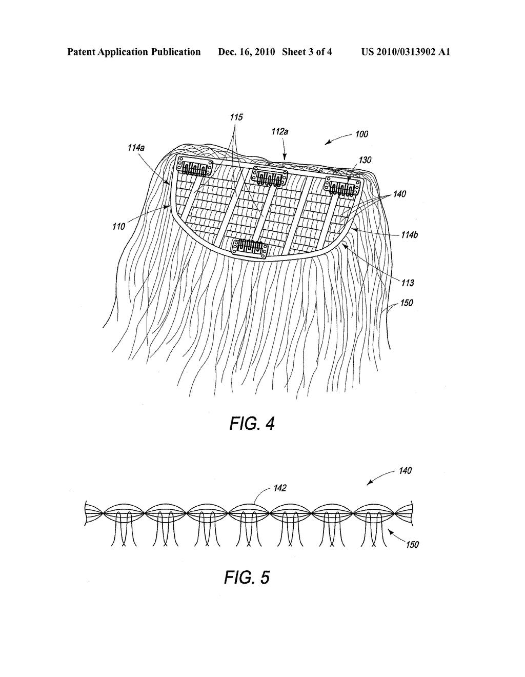 Hair Addition For Providing Bump Up Effect - diagram, schematic, and image 04