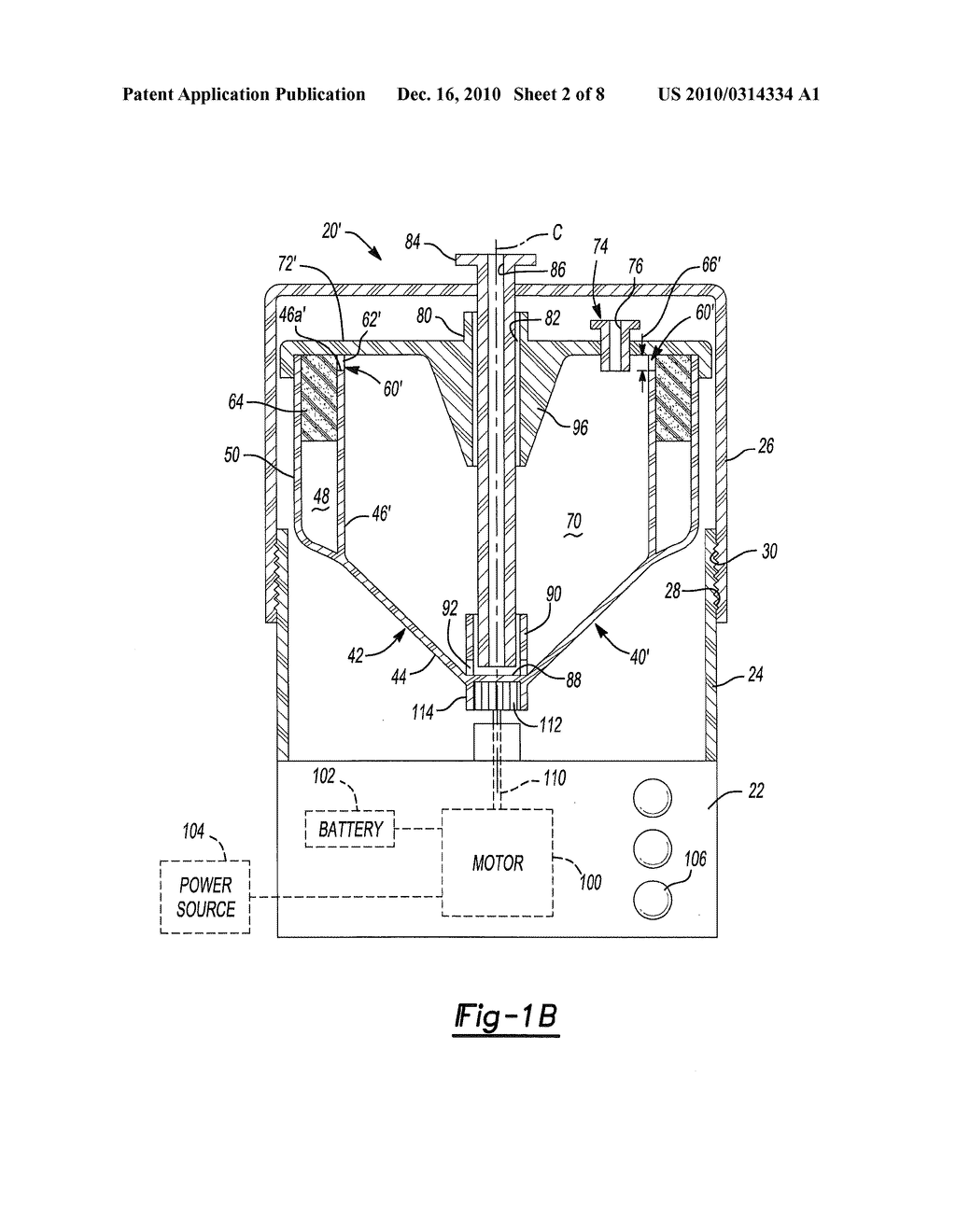 Liquid Separation From Adipose Tissue - diagram, schematic, and image 03