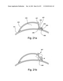 Skin treatment dispenser and method of manufacture diagram and image