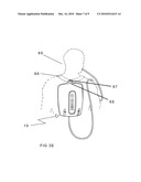 HANDS-FREE HYDRATION SYSTEM FOR NON-AMBULATORY USERS diagram and image